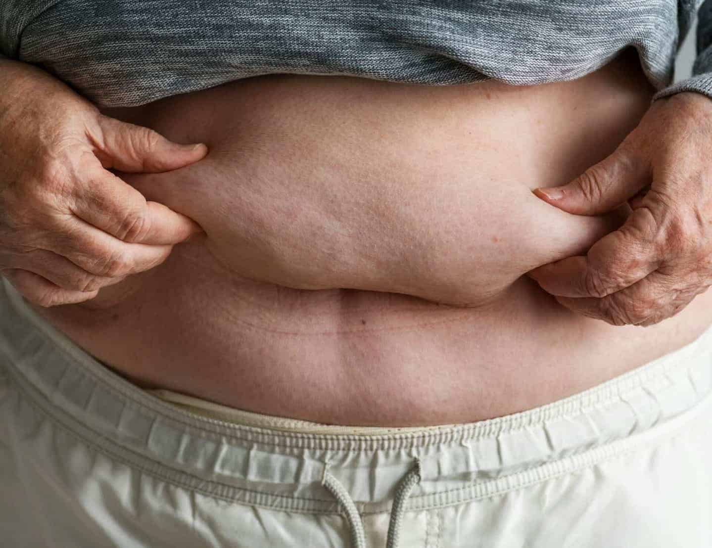 How a Tummy Tuck Can Support an Active Lifestyle in Your 60s
