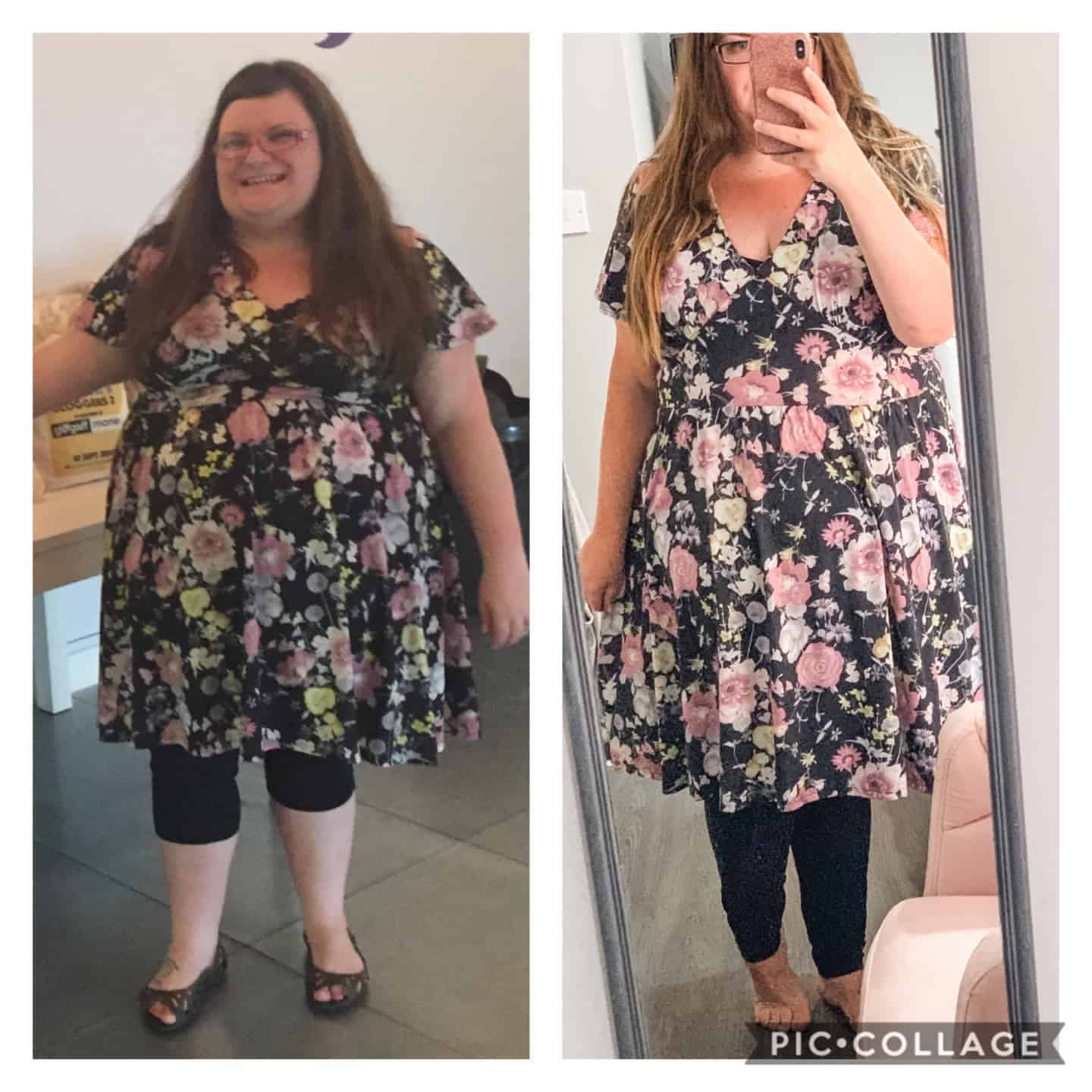 Before and after photos of weight loss surgery Emma in a beautiful dress