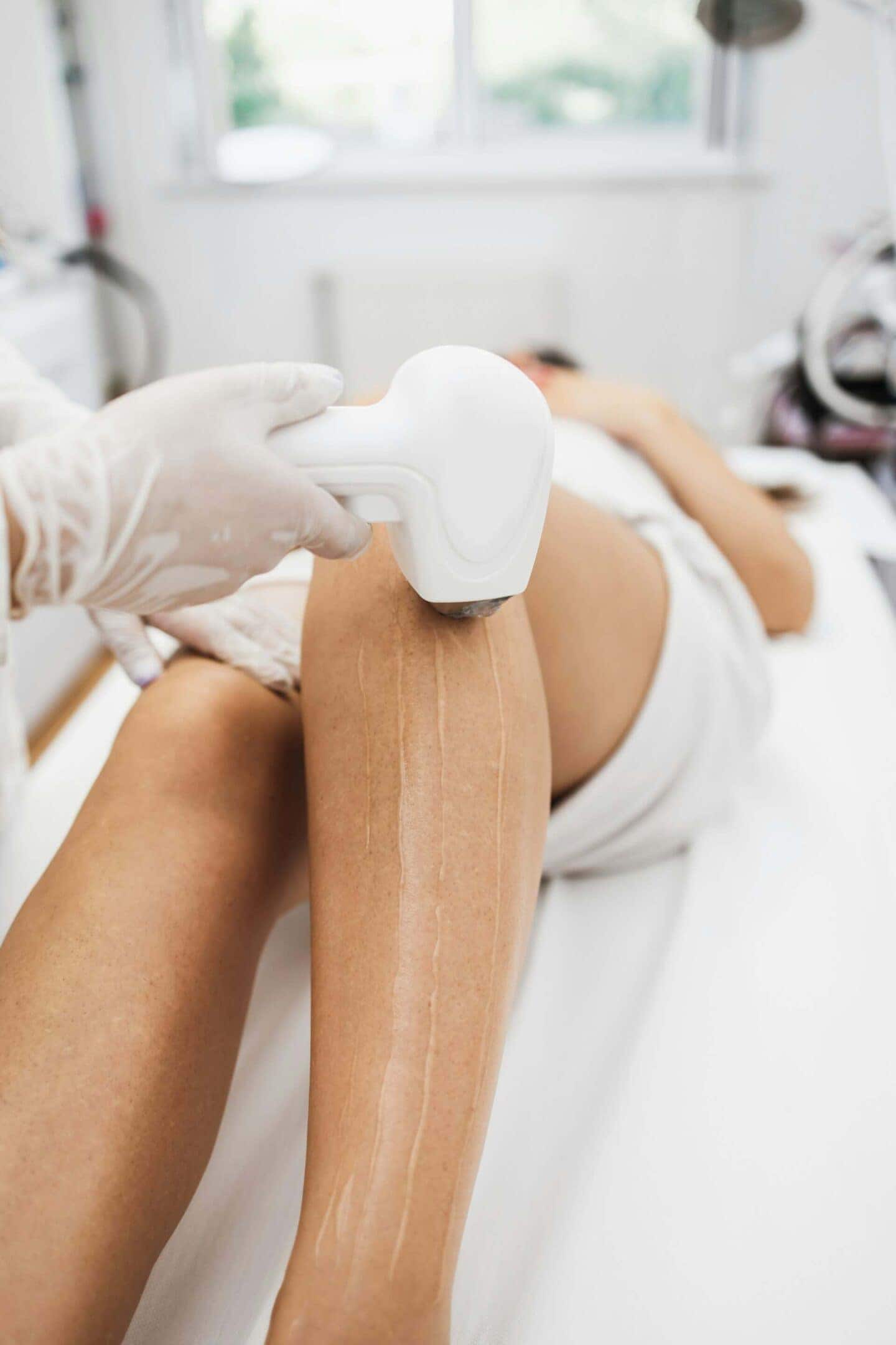 Top 5 Reasons to Swap Your Waxing Appointments for Laser Hair Removal in London