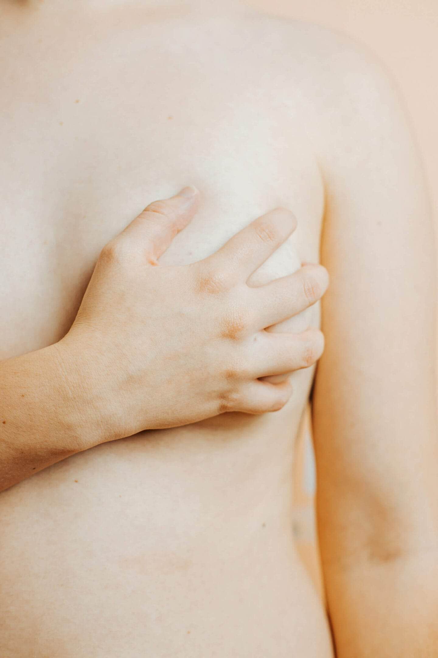 Important Facts About Breast Reduction Scarring