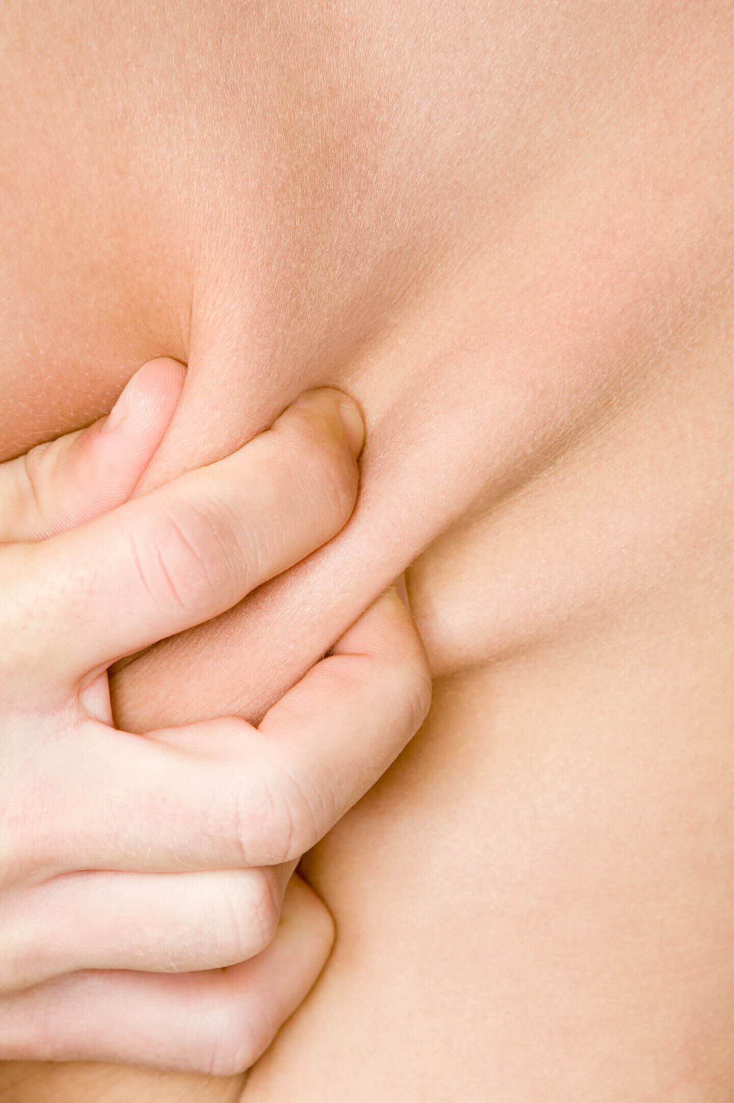 What Makes Someone a Good Candidate for Liposuction? 4 Factors Doctors Look At