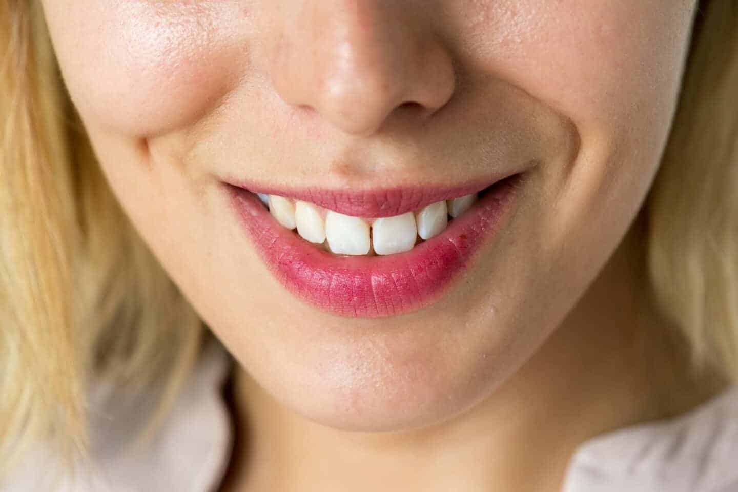 Planning a Smile Upgrade? 4 Things to Expect From Custom Dental Implant Treatments