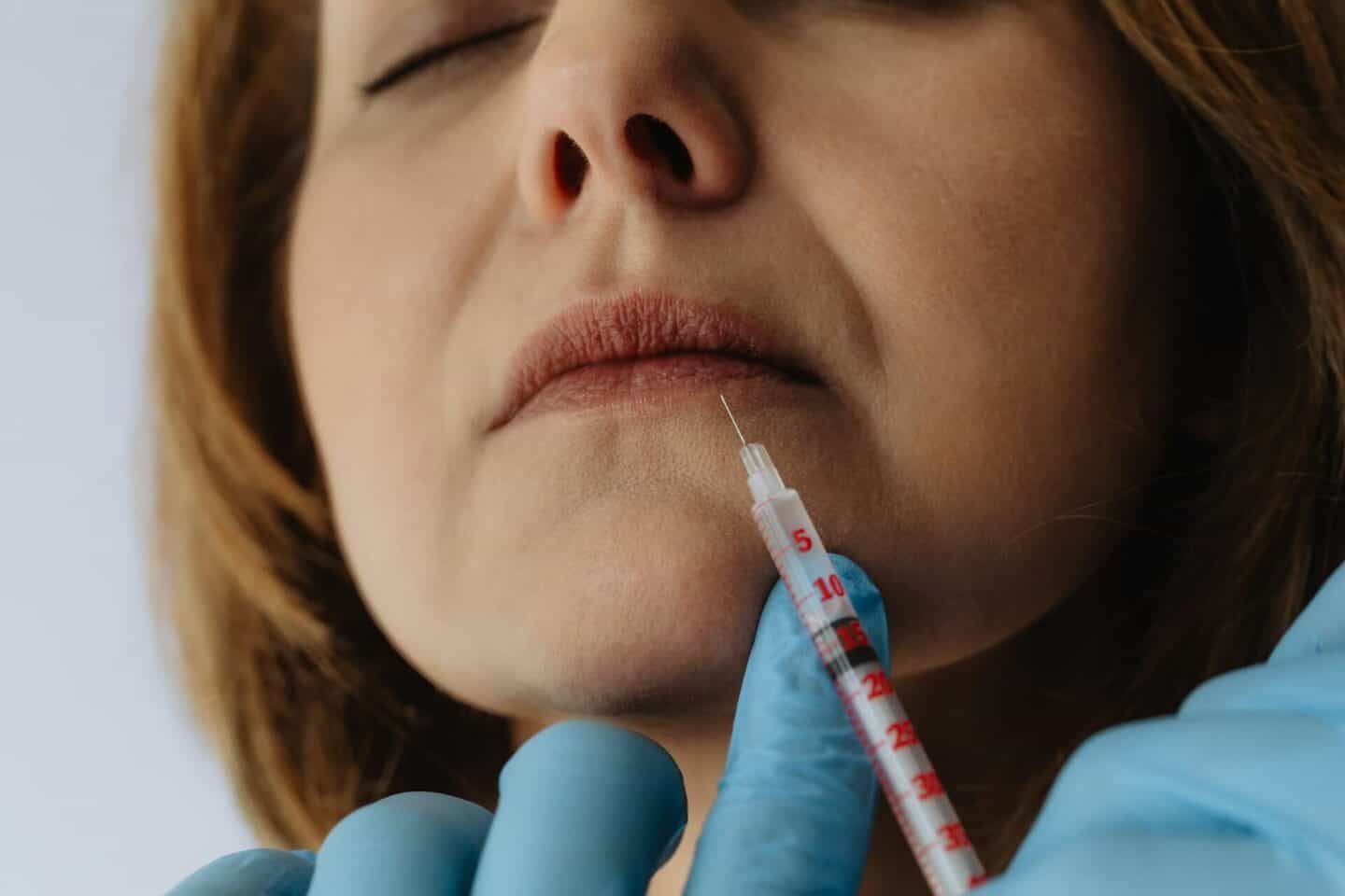 What Makes Lip Injections One of the Most Requested Treatments Today