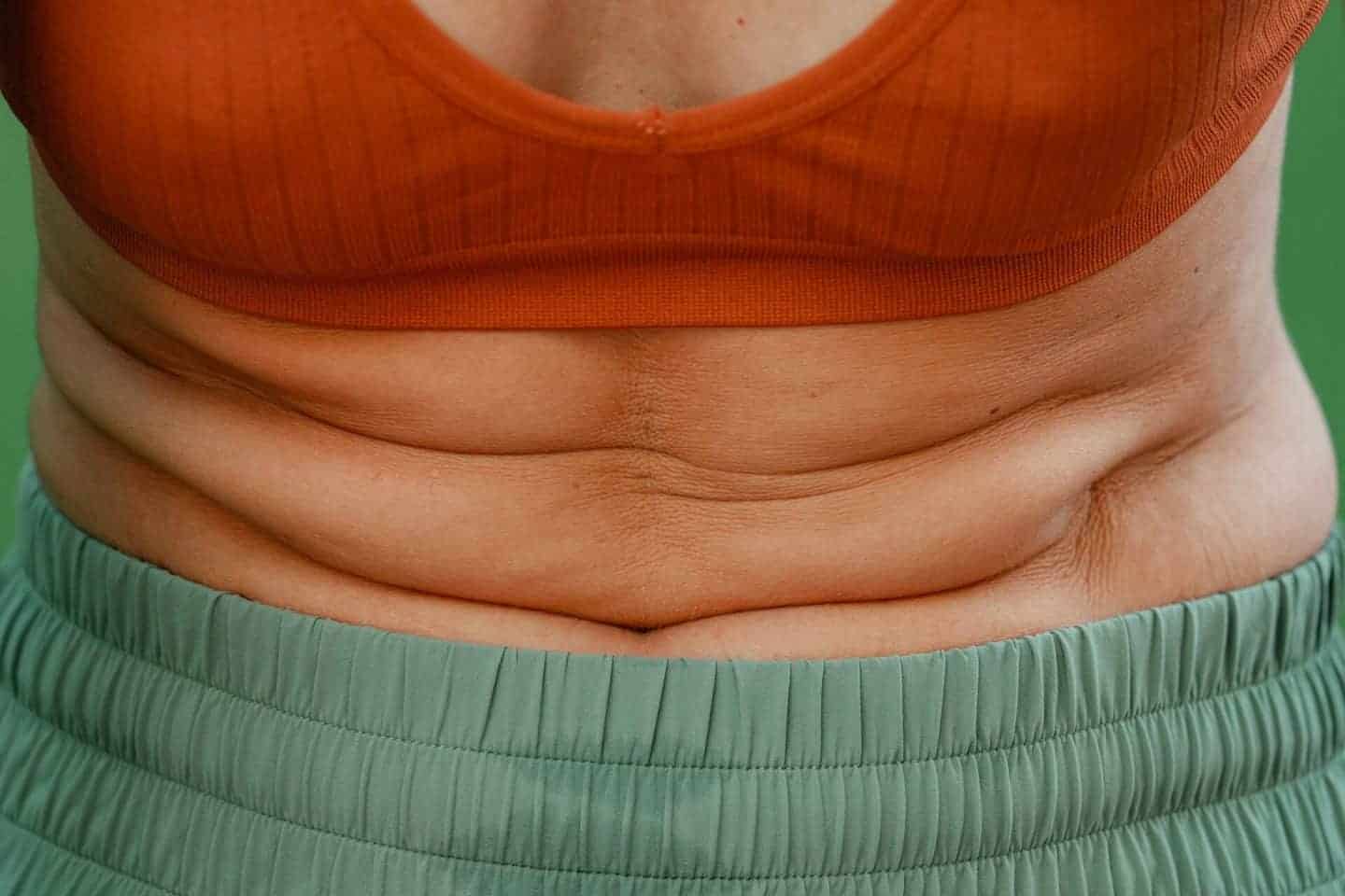 5 Things Moms Should Know Before Considering Liposuction