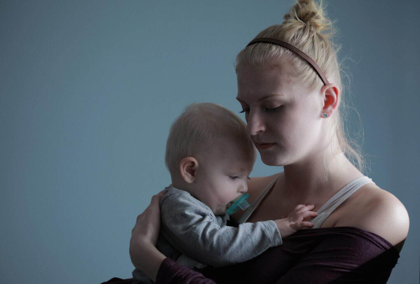 Postpartum Hair Loss - When Will It Stop?