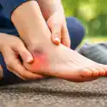 heel contusion