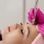 Microdermabrasion - cosmetic procedures every women should know