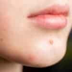 Skin Problems That Could Be Signs Of Something Bigger