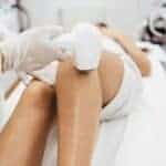 Top 5 Reasons to Swap Your Waxing Appointments for Laser Hair Removal in London