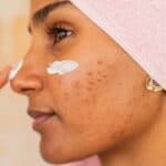 Common Skin Issues Women Face - And How a Dermatologist Can Help
