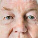 What Should You Know Before Exploring Cataract Surgery Options?