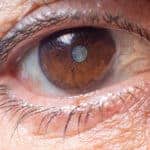 Mueller Vision: Cataract and Lens Decisions that Feel Less Overwhelming