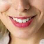 Planning a Smile Upgrade? 4 Things to Expect From Custom Dental Implant Treatments