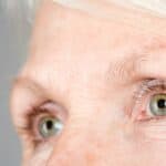 Vision issues from droopy eyelids? Learn the signs eyelid surgery may help—blocked sightlines, eye strain, headaches and tired-looking eyes.