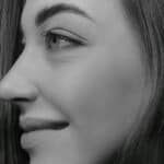Cheek Fillers: How They Can Help Restore Facial Volume