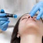 Common Skin Concerns a Hydrafacial Can Actually Help You Finally Fix