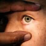 Getting Laser Vision Surgery