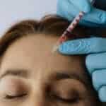 How Botox smooths forehead lines, Frown Lines, and Crow's Feet