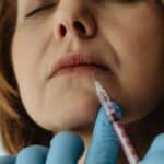 What Makes Lip Injections One of the Most Requested Treatments Today