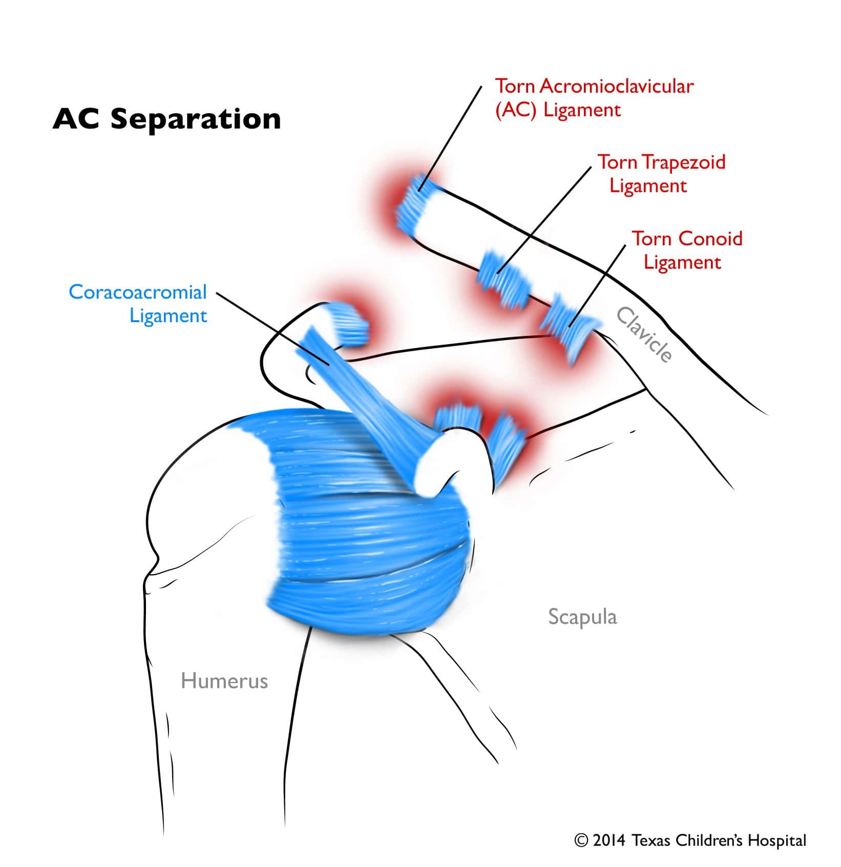 AC Separation