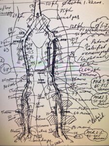 LE arterial duplex worksheet