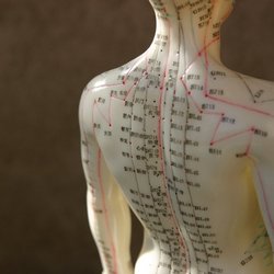 acupuncture-san-diego