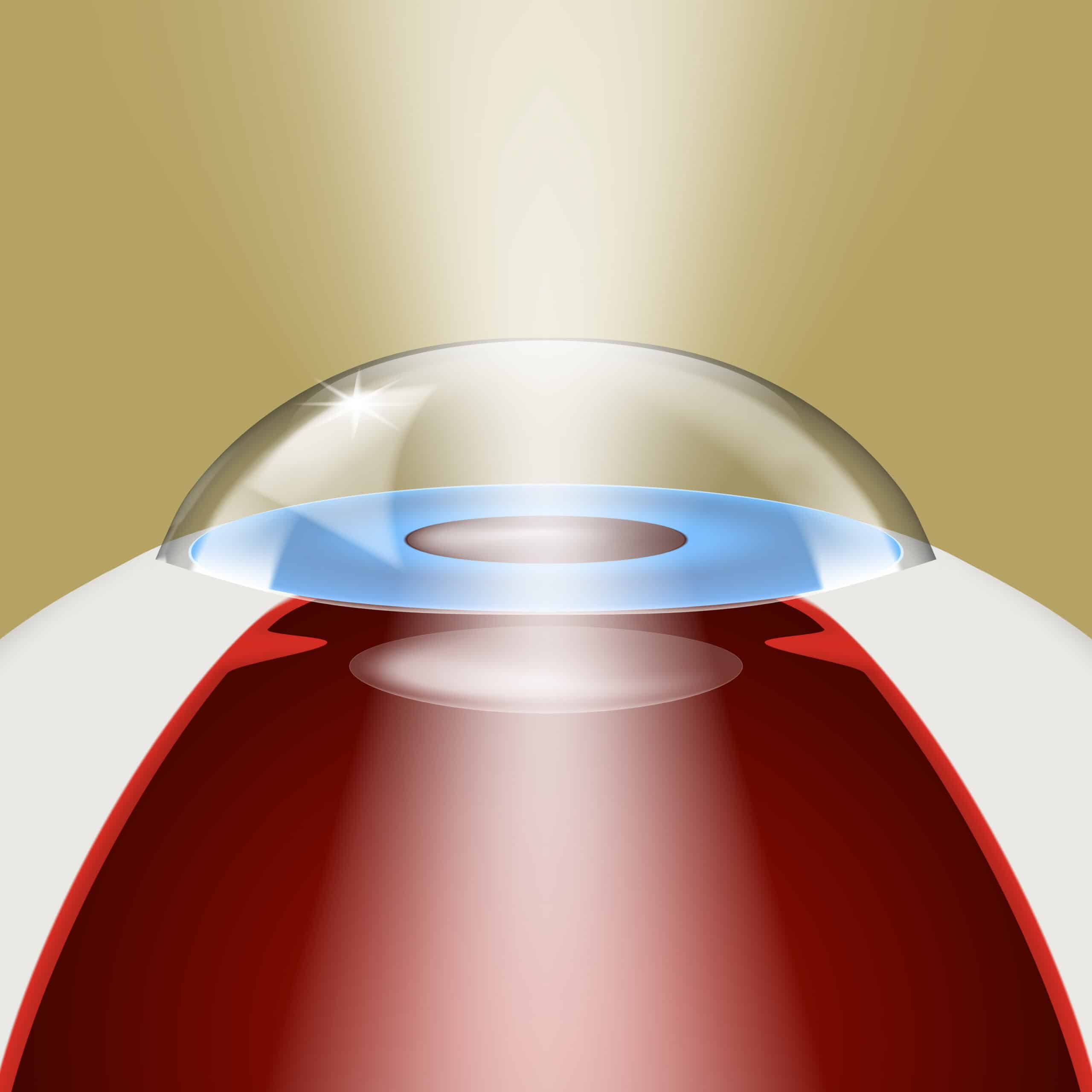 About Us 7 Phacoemulsification Cataract scaled-Eye Hospital In Pune