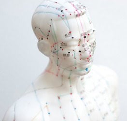 San Diego acupuncturist