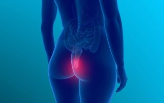 Haemorrhoid pain illustration