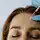 How Botox Smooths Forehead Lines, Frown Lines, and Crow's Feet