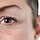 How Eyelid Surgery Can Transform Your Appearance: Key Benefits of Blepharoplasty