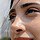 How a Nose Job Can Change Your Profile Without Changing Your Face