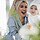 Why Busy Moms Are Choosing Botox for a Naturally Refreshed Look