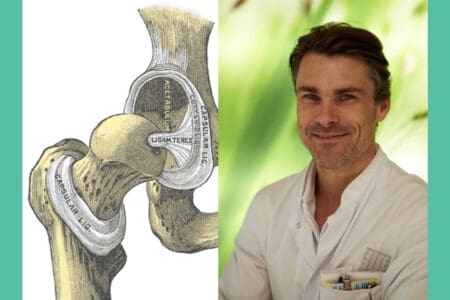 Hüftdysplasie Symptome: Experte PD Dr. Dornacher