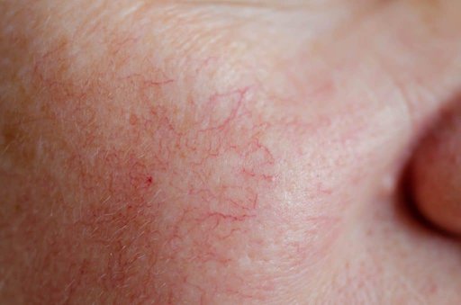 facial enzyme