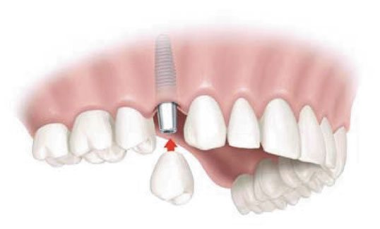 dental surgery