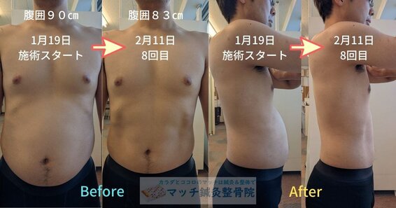 新世代EMS電磁パルス|ダイエット|体幹トレーニング│札幌市中央区大通