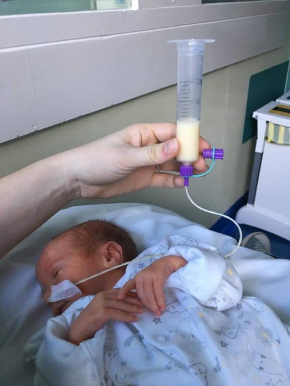 tube feeding a preemie baby
