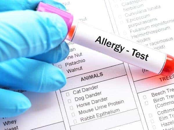 allergy test blood test