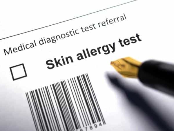 allergy testing forms