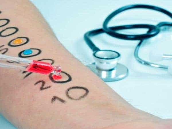 A close up of skin prick testing