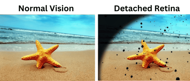 Normal Eye 4-Eye Hospital In Pune