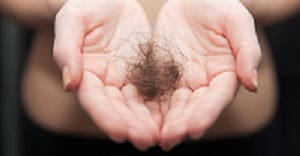 Hair Loss