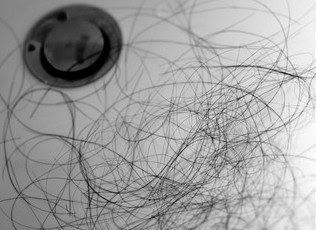 hair-falling-out