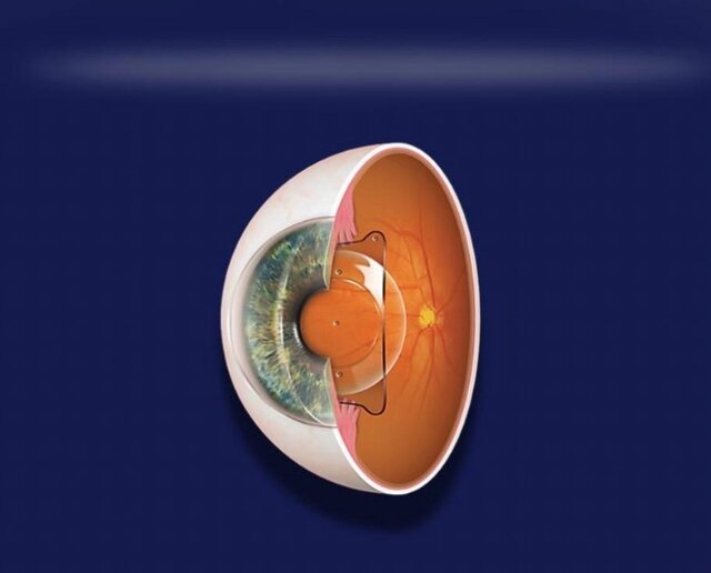 WhatsApp Image 2026 01 24 at 16.31.20-Eye Hospital In Pune