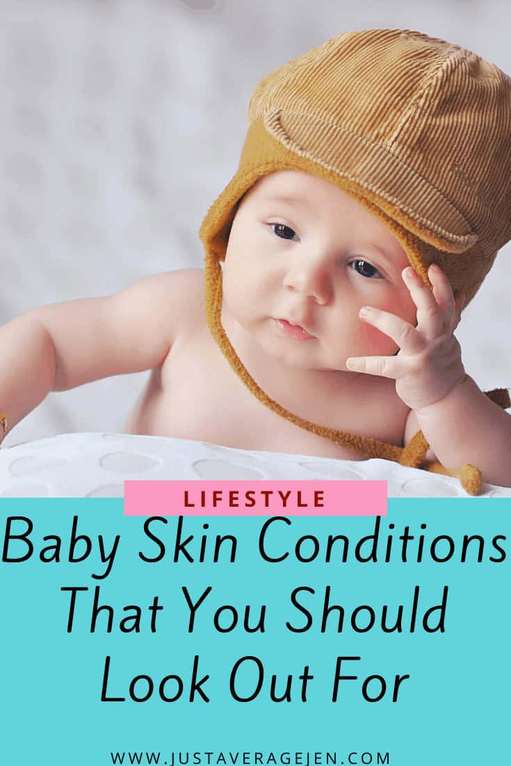 Baby Skin Conditions That You Should Look Out For