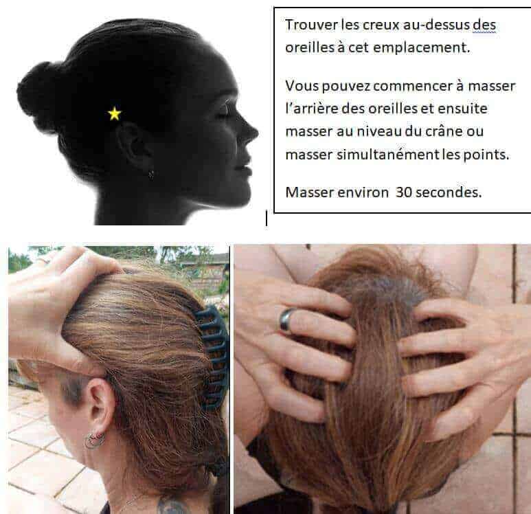 glande pinéale ou épiphyse