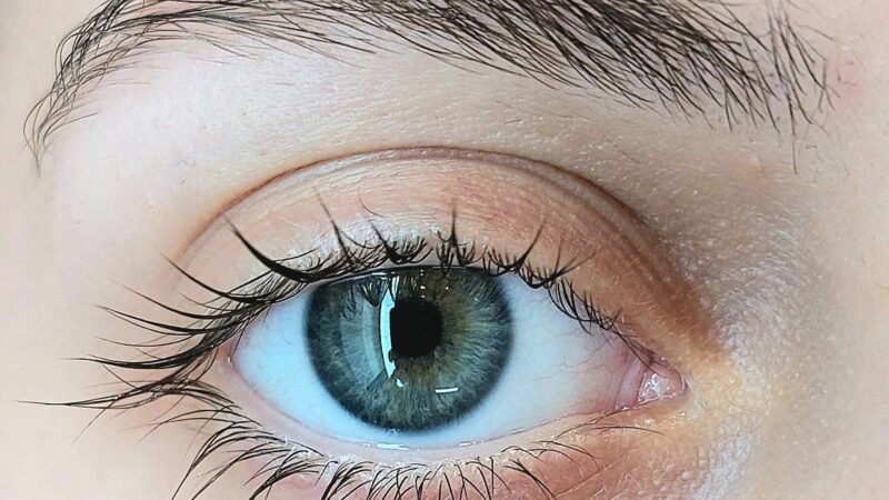 How Eyelid Changes Can Affect Facial Balance and Expression