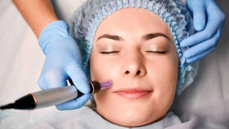 Why Disposable Cartridges Are Important for Safe Microneedling