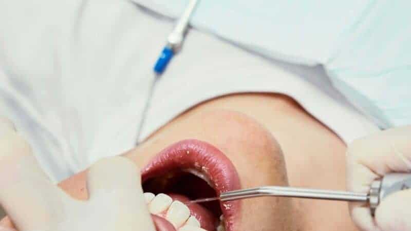 How Dental Reconstruction Can Restore More Than Just Your Smile